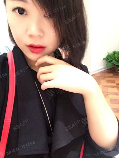 氧气xr00q激光祛斑第10天美丽日记-新氧美容整