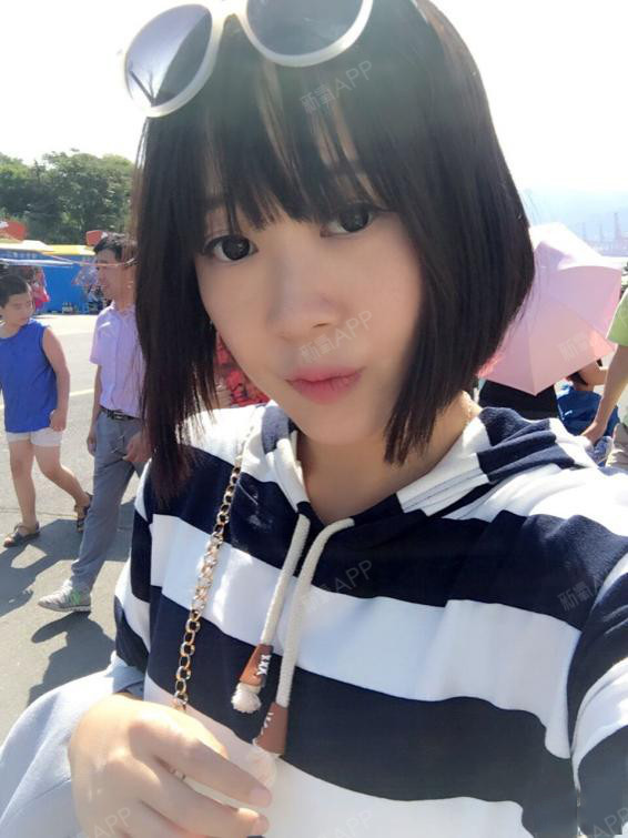 氧气xr00q激光祛斑第10天美丽日记-新氧美容整