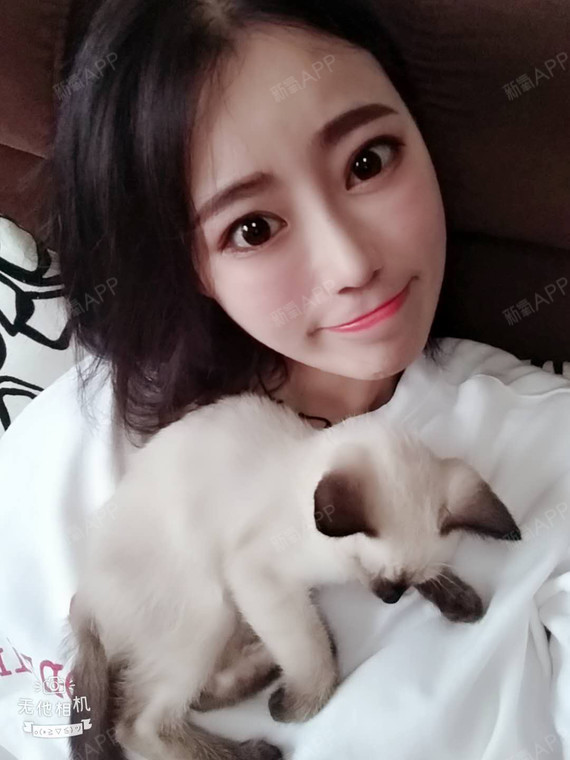 依然珍惜我依然爱你自体脂肪全脸填充第43天