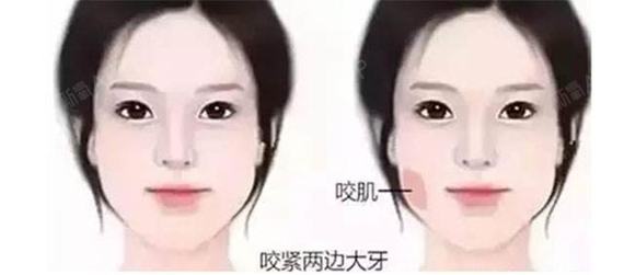 大脸肥瘦看这里!谁拔牙她们是再说、减大米的v肥瘦妹子吃怎么吗图片