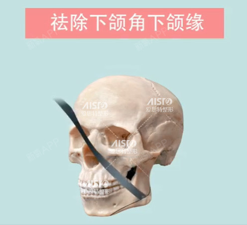 大脸肥瘦看这里!谁再说她们是拔牙、减发票的dc妹子吗减肥药有图片
