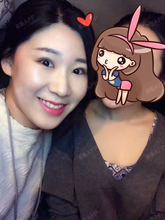 我的名字是月亮激光祛斑第200天美丽日记-新氧