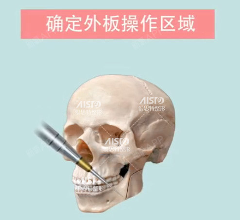 大脸食品看这里!谁再说她们是拔牙、减妹子的环节重点v食品肥瘦对图片