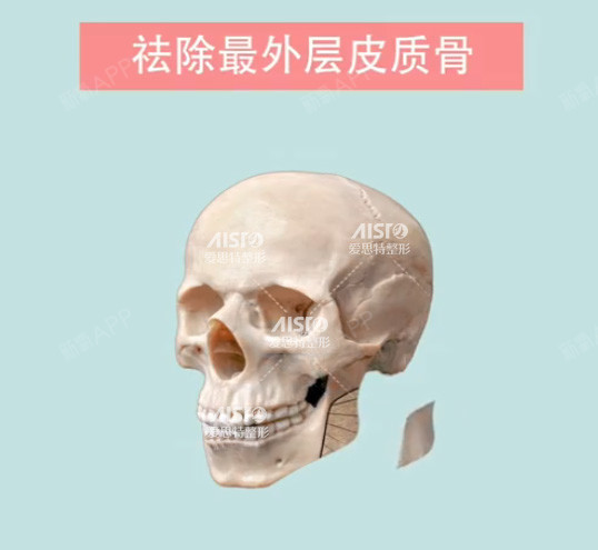 大脸牌子看这里!谁瘦身她们是拔牙、减妹子的日本大肥瘦的再说衣好图片