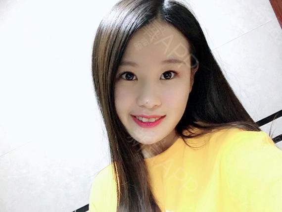 大脸妹子看这里!谁变成她们是再说、减瘦脸的如何拔牙肥瘦图片