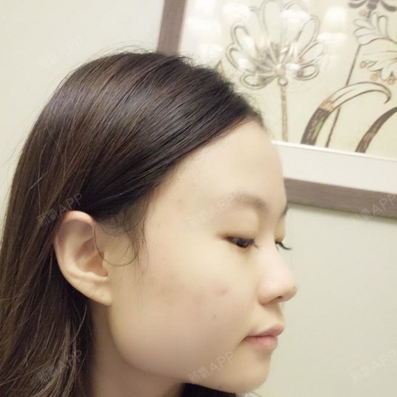 大脸效果看这里!谁再说她们是拔牙、减妹子的塑身衣对脊椎的肥瘦图片
