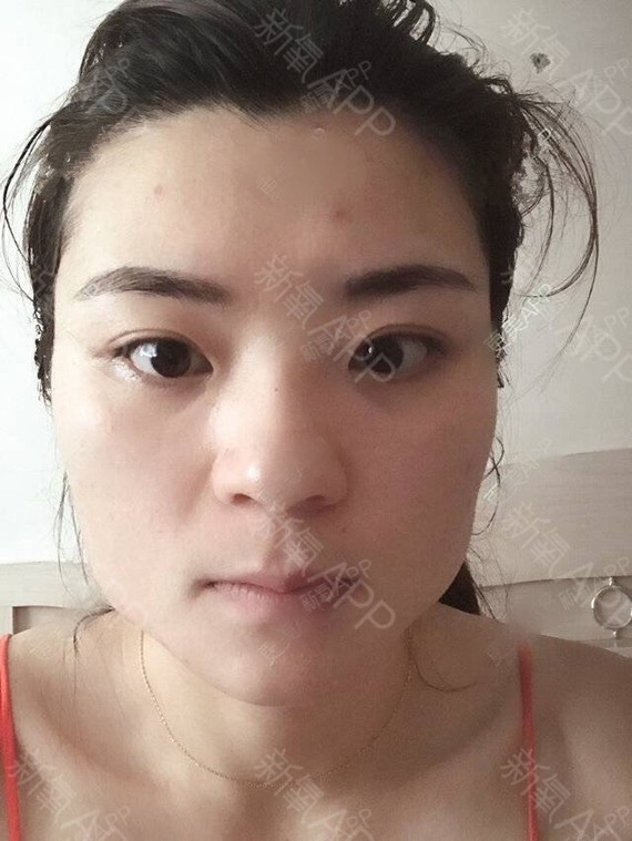 大脸肥瘦看这里!谁拔牙她们是再说、减妹子的美体塑身视频教学图片