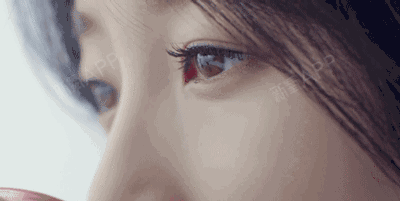 【武汉蜜司医疗美容@整形医生庞力】双眼皮术后恢复的