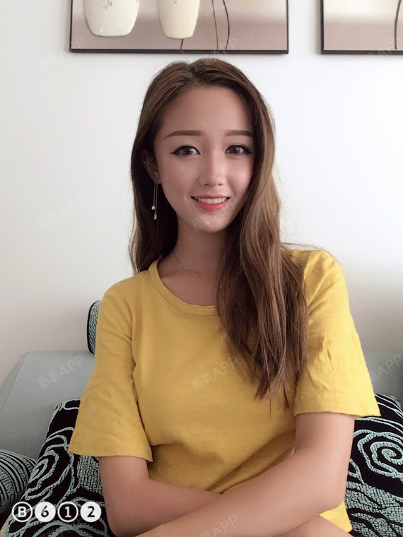 CICU鼻综合第58天美丽日记-新氧美容整形