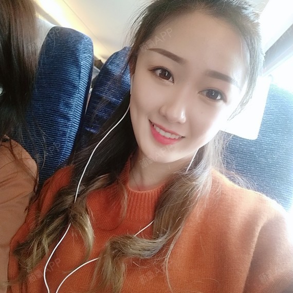 CICU鼻综合第58天美丽日记-新氧美容整形