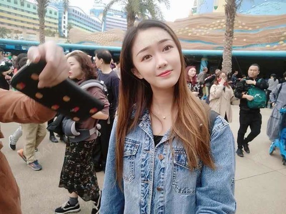 CICU鼻综合第58天美丽日记-新氧美容整形