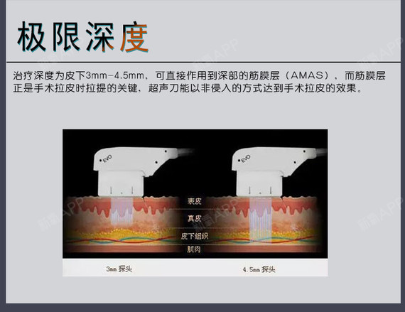 【超声刀】【ulthera美版抗衰神器】无创无痛,提升紧致全脸v脸,除皱