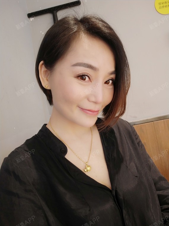 我是一只小燕子埋线提升第60天美丽日记