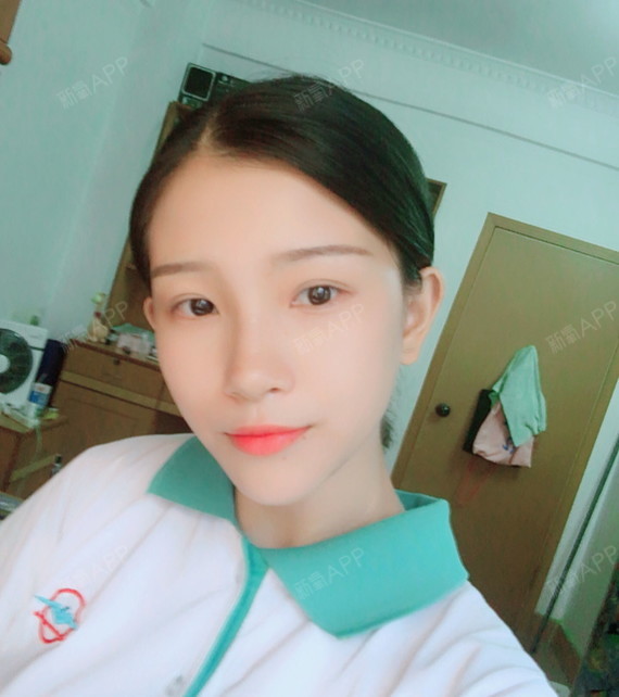 veee偏爱你自体脂肪全脸填充第201天美丽日记