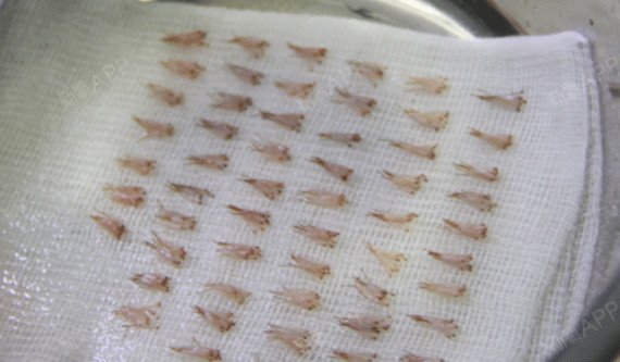 去植发,应该需要种植多少的毛囊数量