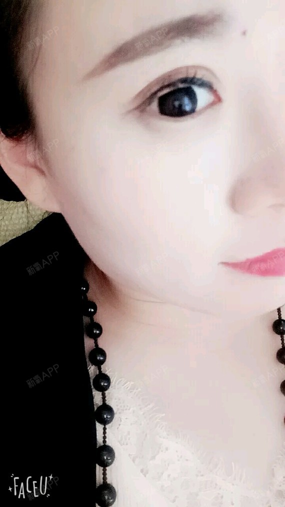 美丽秘密去妊娠纹第1天美丽日记-新氧美容整形