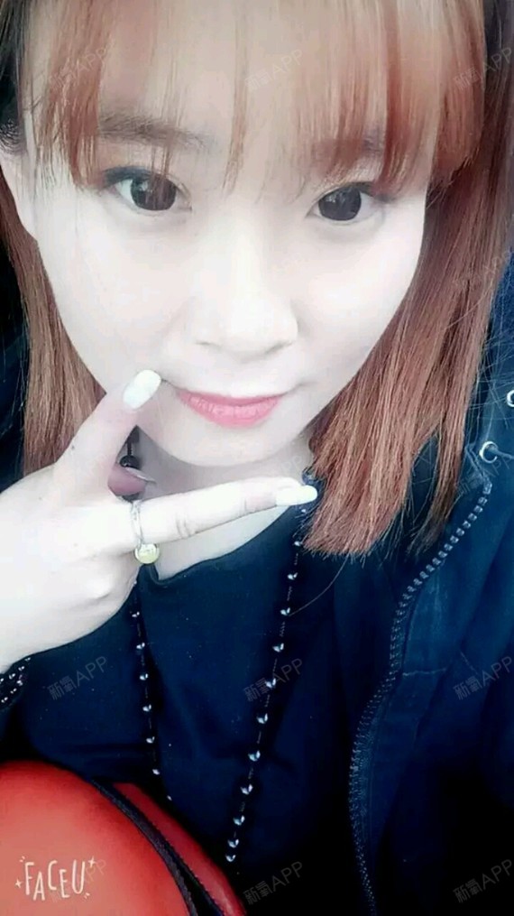 美丽秘密去妊娠纹第1天美丽日记-新氧美容整形