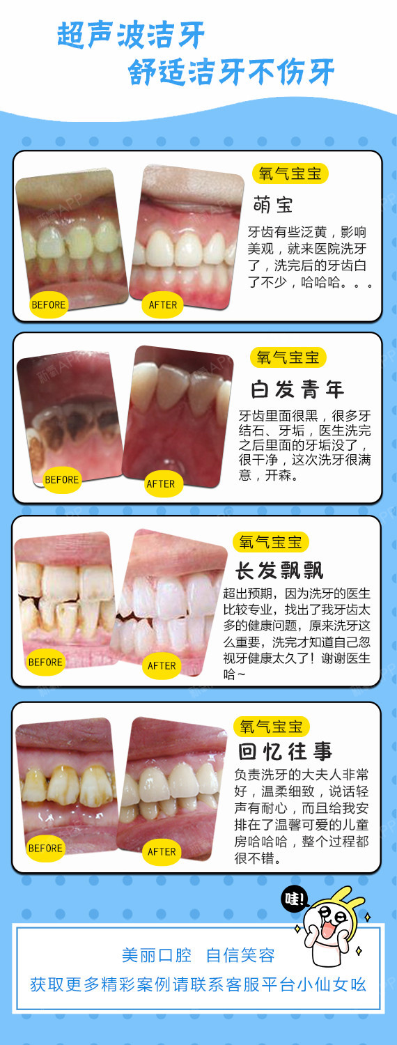 【超声波洗牙】超声波洁牙 抛光套餐 360°深度清洁 牙齿更健康