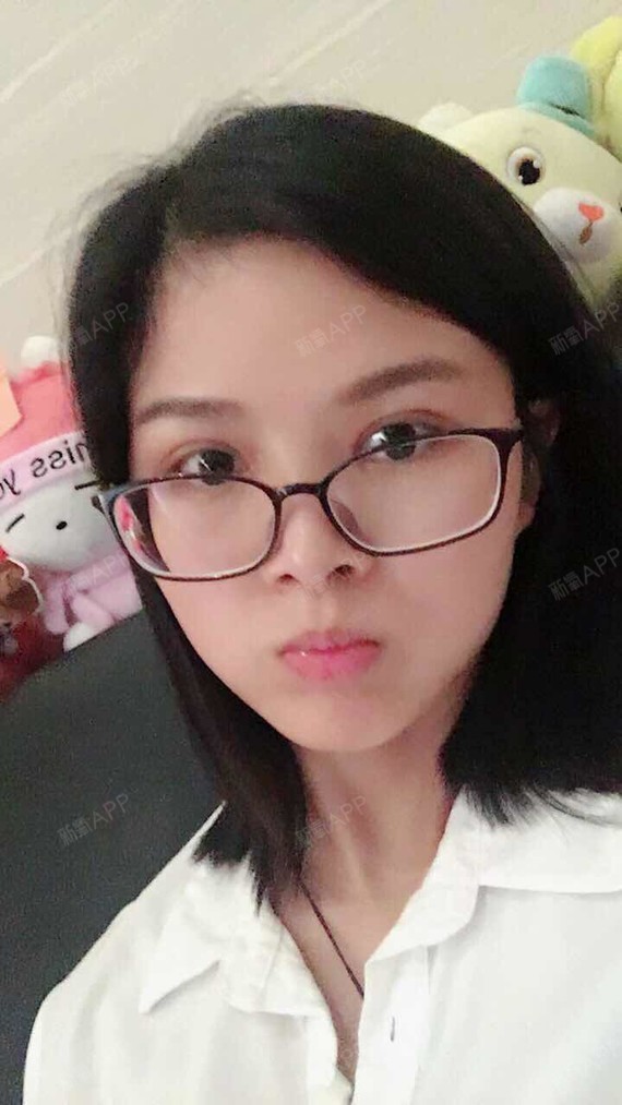 粉红红粉宝宝开内眼角第35天美丽日记