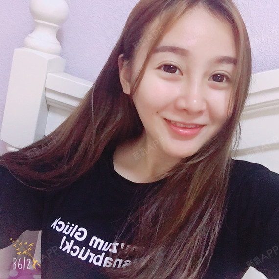 撒有那拉鼻综合第136天美丽日记-新氧美容整形