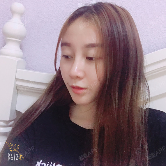 撒有那拉鼻综合第136天美丽日记-新氧美容整形