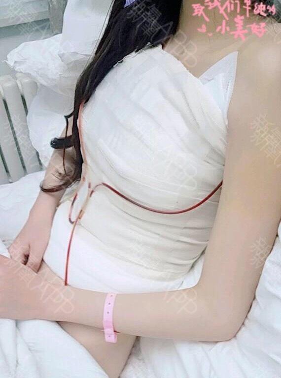 假体隆胸第0天