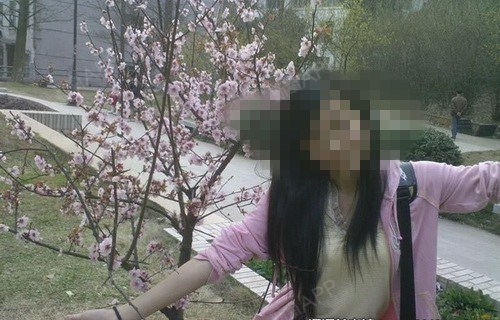 上海虹桥医院腋臭科肉毒素去狐臭第1天美丽日