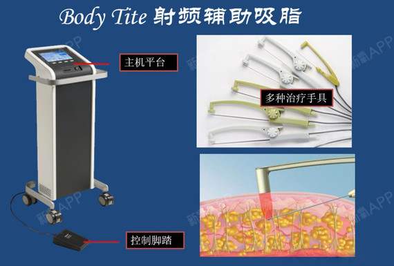 黄金微雕宝丽太,吸脂术后不用穿塑身衣的时代来了