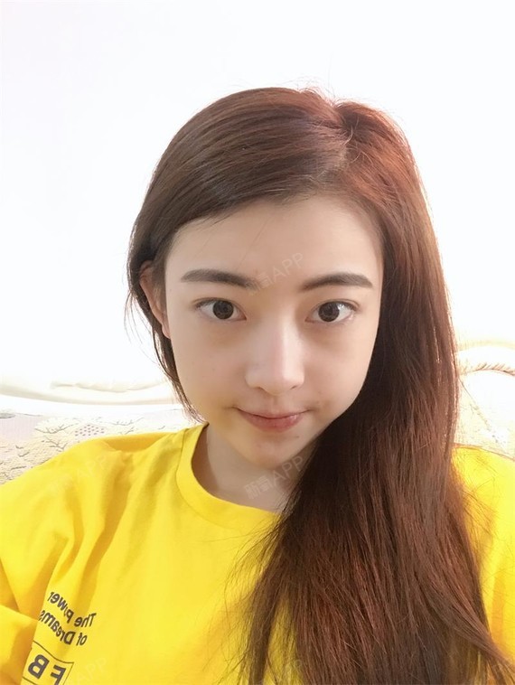 阳光下的泡沫i激光去眼袋第17天美丽日记-新氧