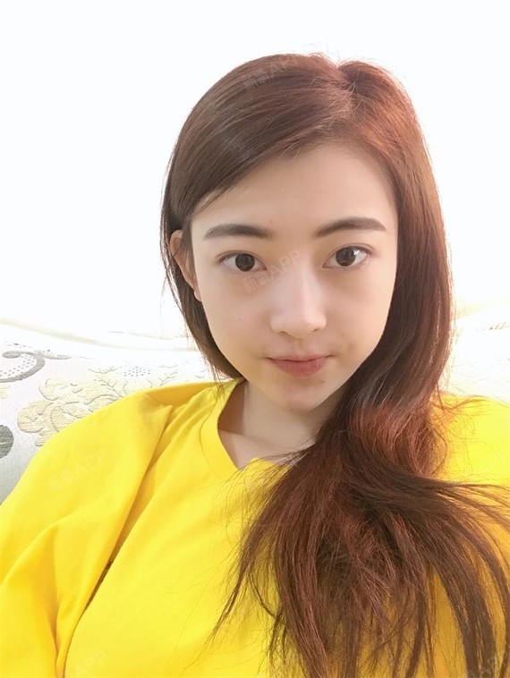 阳光下的泡沫i激光去眼袋第17天美丽日记-新氧