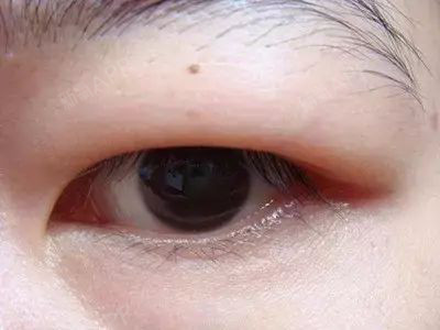 据说眼睛也有黄金年龄段,这真的科学吗?眼睛在