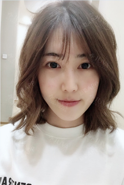 #仪式感生活就去这#肌肤敏感治疗#红光#纳米