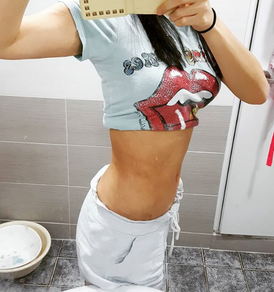 吸脂瘦腰腹怎么样_恢复过程_效果如何_氧气xshh9整形