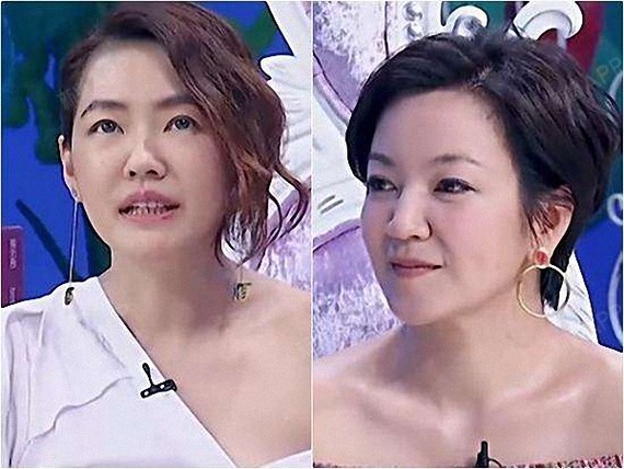 新氧 - 氧气姐 | 北京同城 | 整形纯干货 | 氧姐科普 | 瘦脸针才是小脸神器 | 真人案例 | 医美整形 | 干货科普 新氧 - 氧气姐 | 北京同城 | 整形纯干货 | 氧姐科普 | 瘦脸针才是小脸神器 | 真人案例 | 医美整形 | 干货科普