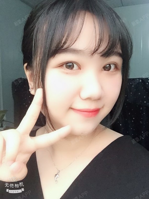 阿尔法的猫切开双眼皮第76天美丽日记-新氧美