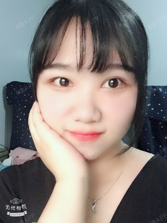 阿尔法的猫切开双眼皮第76天美丽日记-新氧美