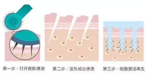 经常听到皮肤医生或医美咨询师说,你皮肤做做