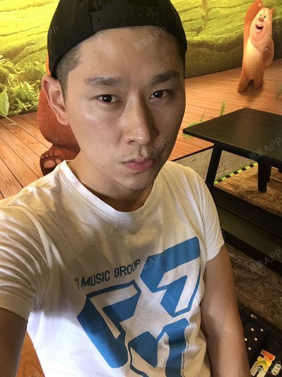 月落幽冥激光去眼袋第101天美丽日记-新氧美容