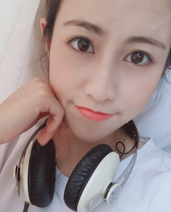 氧气x17hl自锁托槽矫正第0天美丽日记-新氧美