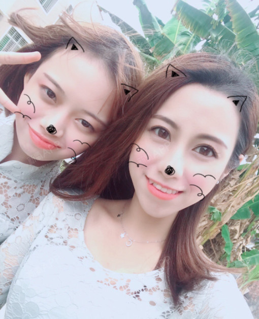 氧气x17hl自锁托槽矫正第0天美丽日记-新氧美