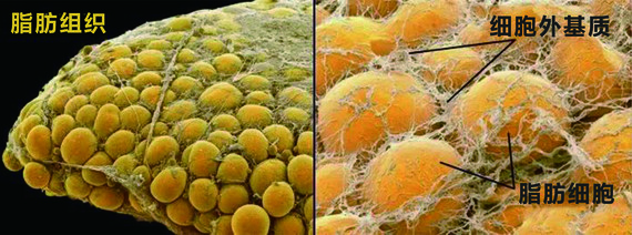 大家同样是脂肪,为什么SVF-gel自体脂肪胶这么