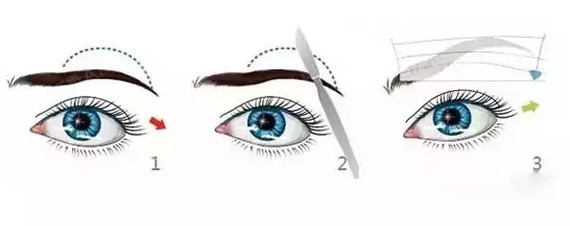 最近宝宝的小姨妈问了我切眉这个事情,通过一段时间的了解,我今天想给大家_圈子-新氧美容整形