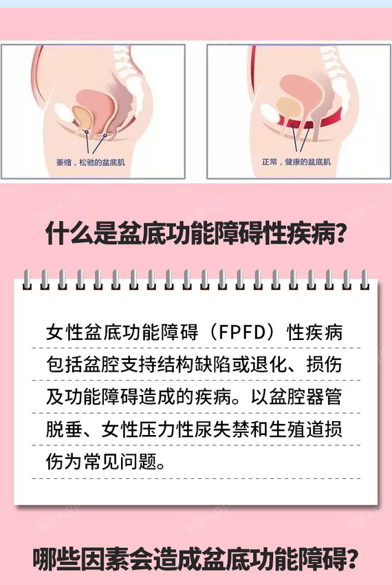全方位盆底肌活力检测评估,唤醒你们的盆底肌