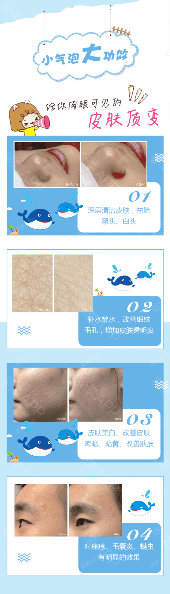 【超微小气泡】【深度补水洁肤】吸附毛孔堵,深层去垢