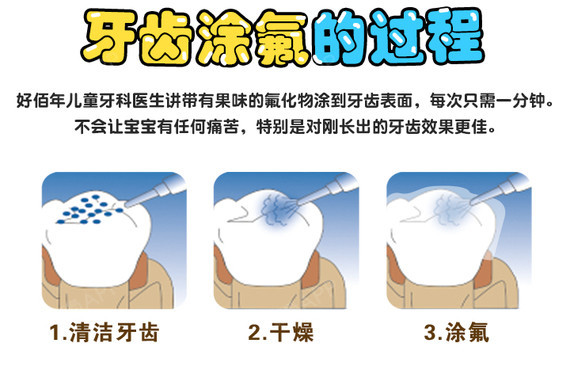 【牙齿综合】儿童全口涂氟防蛀套餐