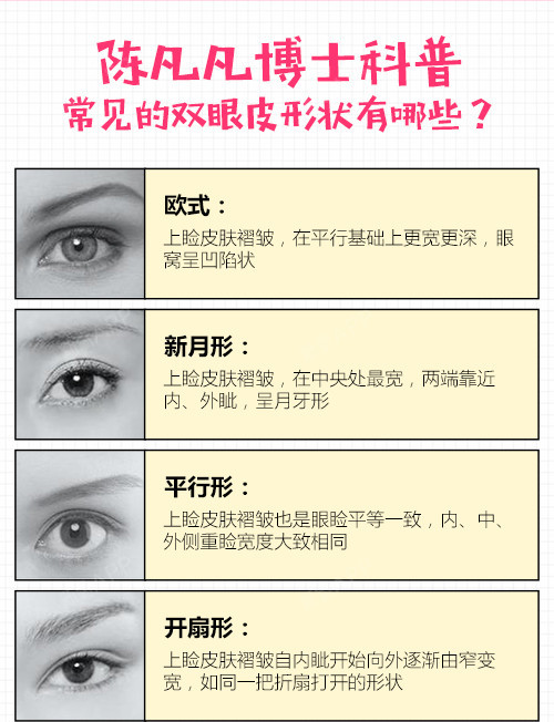 【切开双眼皮】灵动小鹿眼 迷人眼型 九院博士倾心打造