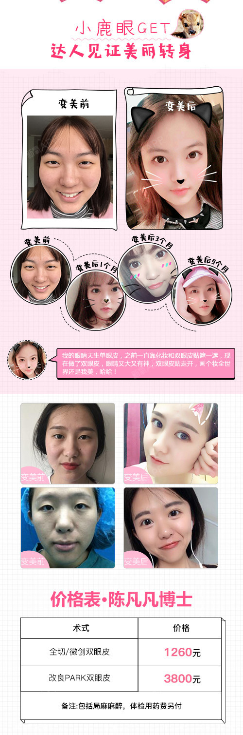 【切开双眼皮】灵动小鹿眼 迷人眼型 九院博士倾心