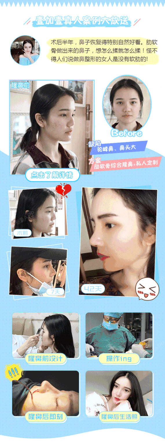 570_1527 竖版 竖屏 gif 动态图 动图