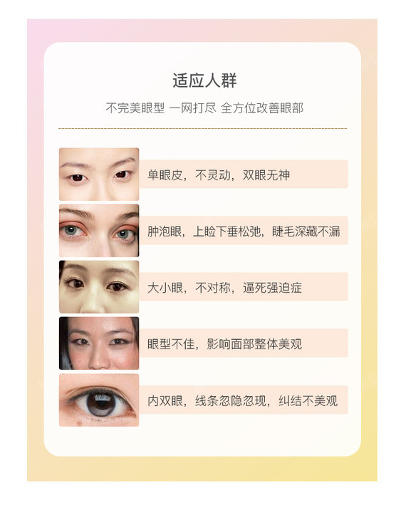 【定点双眼皮】微创双眼皮,韩式三点定位双眼皮,自然灵动,睁眼有神