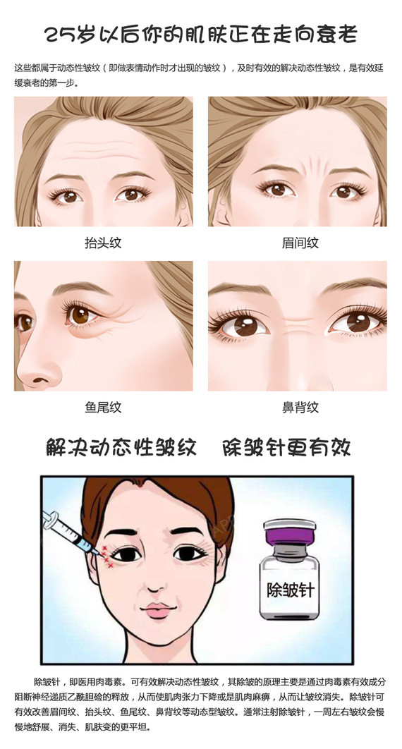 【肉毒素】保妥适 保妥适肉毒素 50单位,保妥适除皱单部位@明星同款